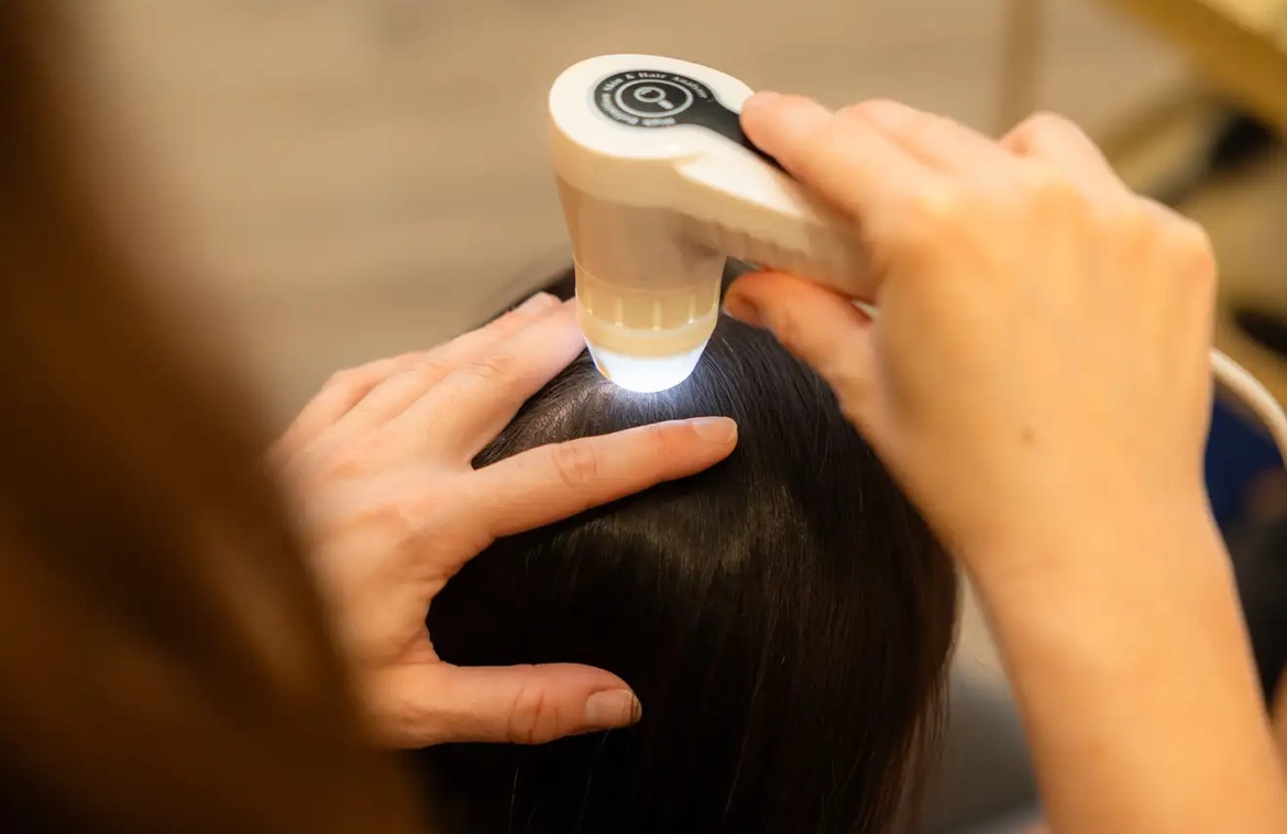 Head Spa Ritual – effective dandruff relief